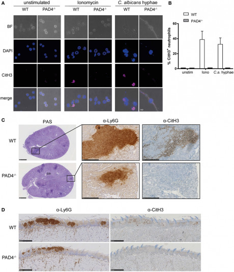 Frontiers Candida Albicans Induced Netosis Is Independent Of Peptidylarginine Deiminase 4